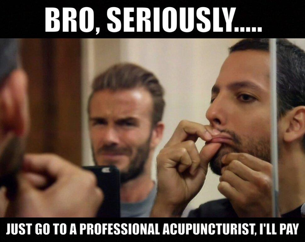 Acupuncture Memes