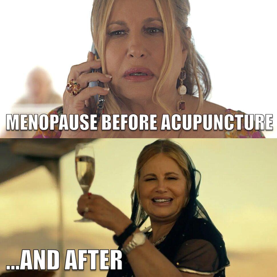 Acupuncture Memes