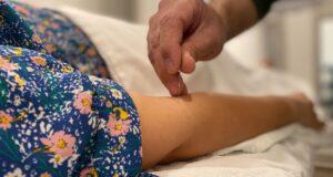 Can Physiotherapists Do Acupuncture Too?