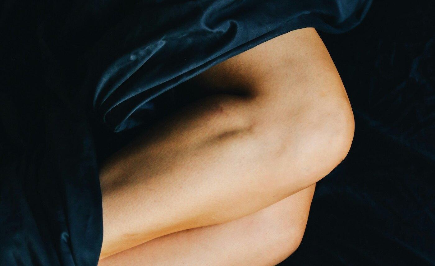 physiotherapist for restless leg syndrome burnaby bc