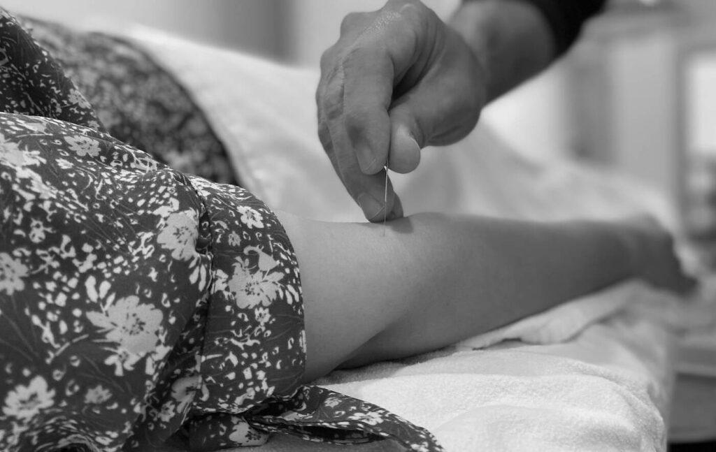 Chinese Medicine Acupuncture Near Me in Burnaby Vancouver BC